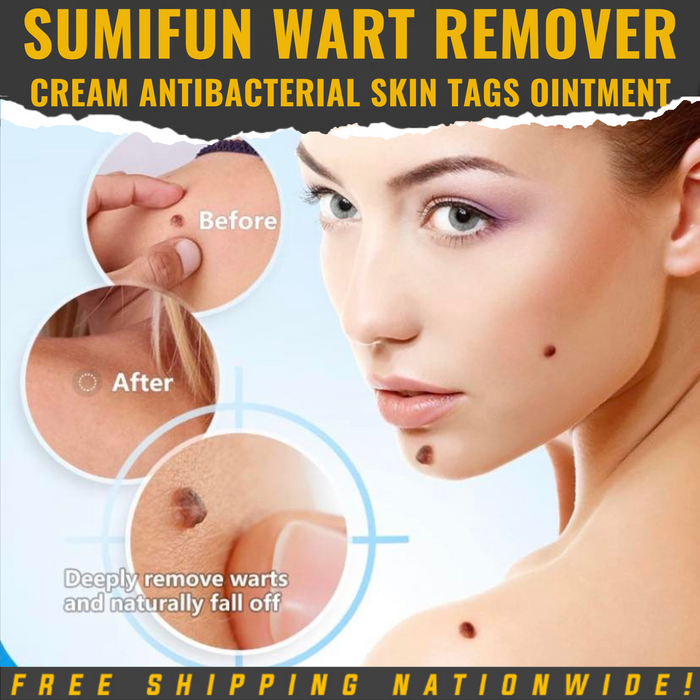 SUMIFUN Wart Remover Cream Antibacterial Skin Tags Ointment