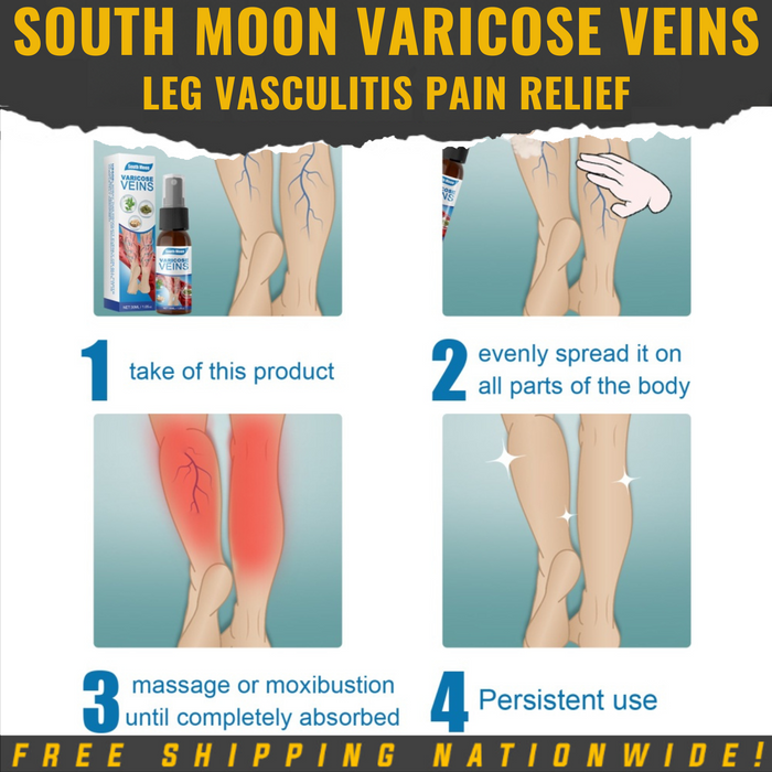 South Moon Varicose Veins Leg Vasculitis Pain Relief